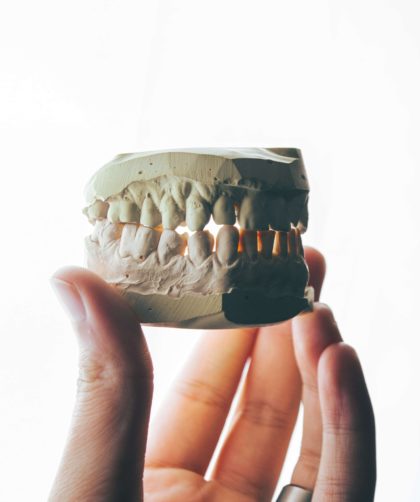 Ranking implantów zębowych - o tym warto wiedzieć!