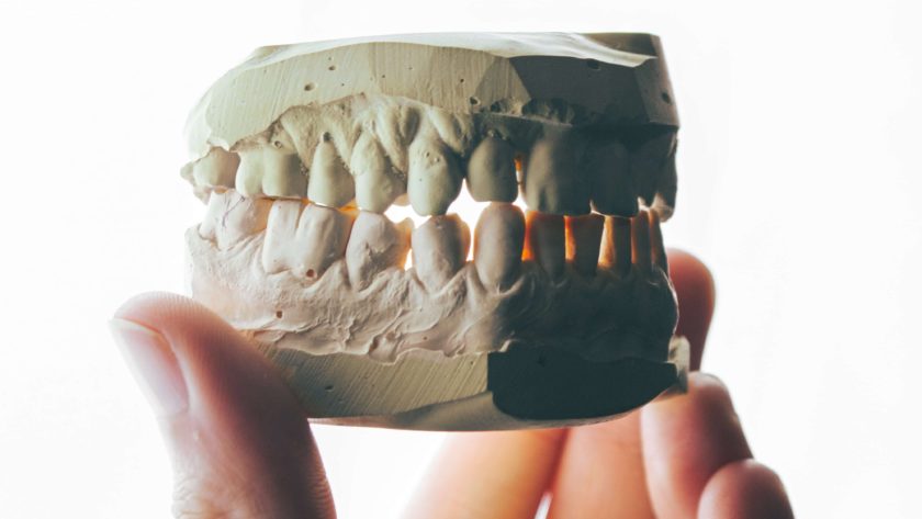Ranking implantów zębowych - o tym warto wiedzieć!